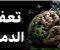 صورة مقال تعفّن الدماغ: كيف تنتزع منك التكنولوجيا والروتين قدراتك العقلية من دون أن تشعر