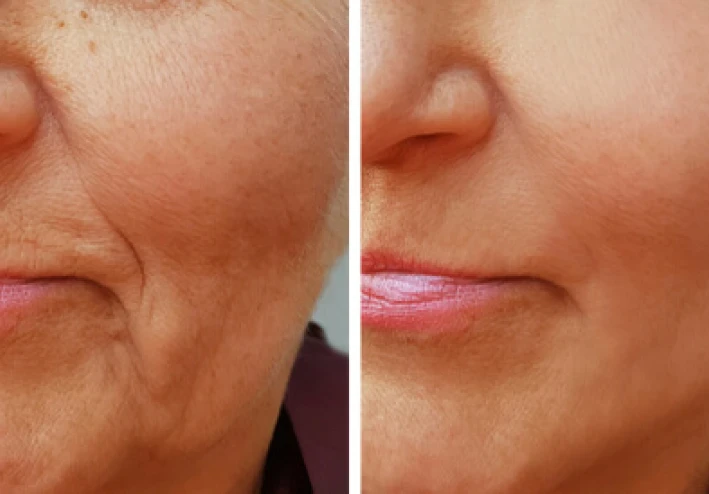 هل الألياف الكولاجين الجديد؟ صورة من هاجس جديد مع هذا الملحق باعتباره التأمين طول العمر