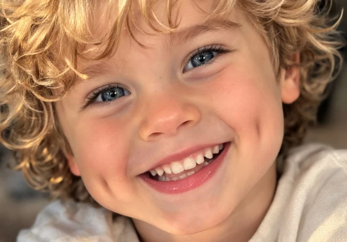 الغمازات .. جمال ام تشوه خلقي