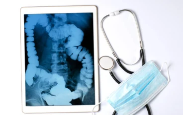 🌀 القولون العصبي: الأسباب، الأعراض، وطرق العلاج الفعّالة