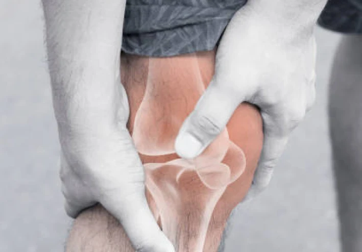 🦵 هل تعاني من ألم الركبة؟ كل ما تحتاج معرفته عن خشونة الركبة