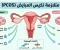صورة مقال 🩺تكيس المبايض صامت لكنه مؤثر - دليل شامل لفهم الحالة والتعامل معها