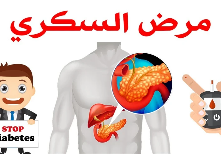 احذر قبل فوات الأوان: كل ما تريد معرفته عن مرض السكري