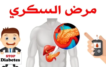 احذر قبل فوات الأوان: كل ما تريد معرفته عن مرض السكري