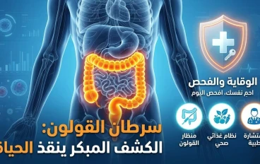 سرطان القولون: أعراض مبكرة لا يجب تجاهلها وأهم طرق الوقاية قبل فوات الأوان