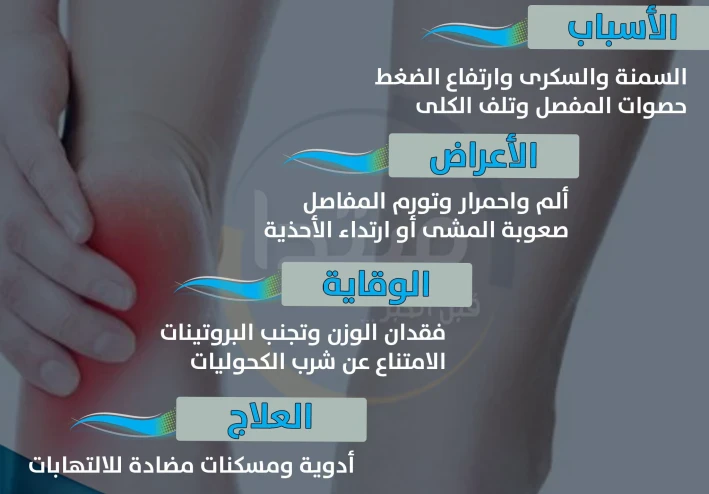 النقرس: لماذا يصيبك فجأة؟ وكيف تعالجه قبل أن يتفاقم