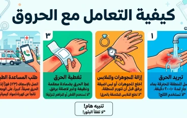 الحروق قد تصبح أخطر مما تتوقع | الإسعافات الأولية الصحيحة للحروق