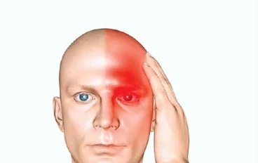 الصداع العنقودي: أسوأ ألم قد يضرب رأسك فجأة ويجعلك عاجزًا تمامًا