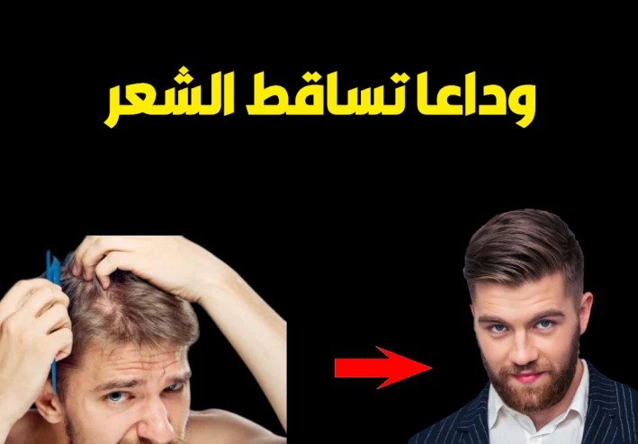 3 طرق سحرية لايقاف تساقط الشعر نهائيا للرجال | علاج تساقط الشعر