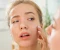How to treat cracked face, elbows and heels