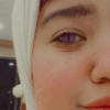 Nourhan MOHAMED